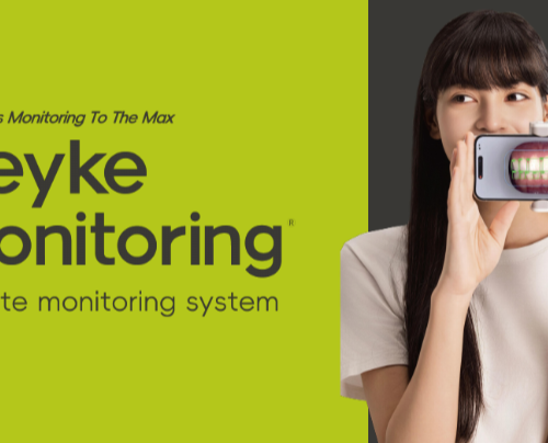 Система мониторинга Beyke Monitoring